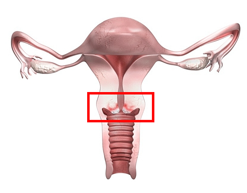 자궁경부 세포 검사, 정상이어도 HPV검사가 필요할까요? 관련 해부 구조 그림