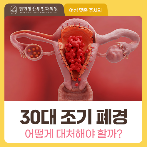 생리가 6개월째 없다면, 조기 폐경 신호일까요?
