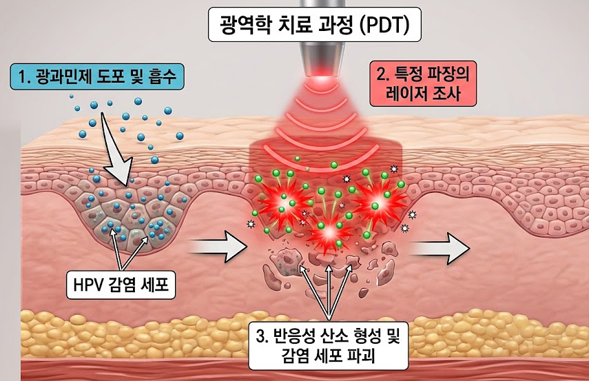 HPV 양성 판정, 꼭 치료가 필요할까요? 관련 해부 구조 그림
